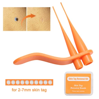 87Pcs מסיר עור תג ערכת 2-7mm תג עור השומה יבלת רגל להסרת יבלות הגוף יבלות טיפול תיקונים לשימוש ביתי הפנים אכפת לי כלי