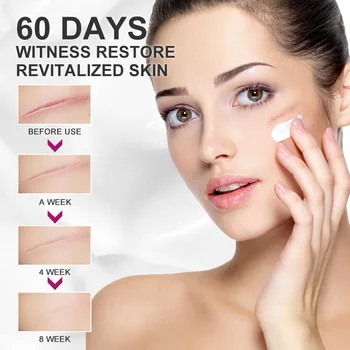 מנגו עור קרם לטיפול בעור תיקון לשפר את גמישות העור טיפוח עור פנים באקנה לעור תיקון קרם להלבנת העור אכפת מוצרים